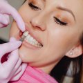 Wisdom Teeth Removal And Porcelain Veneers: A Conroe, TX Cosmetic Dentistry Pairing
