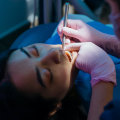 Understanding The Importance Of Family Dentistry Services For Wisdom Teeth Removal In Cedar Park